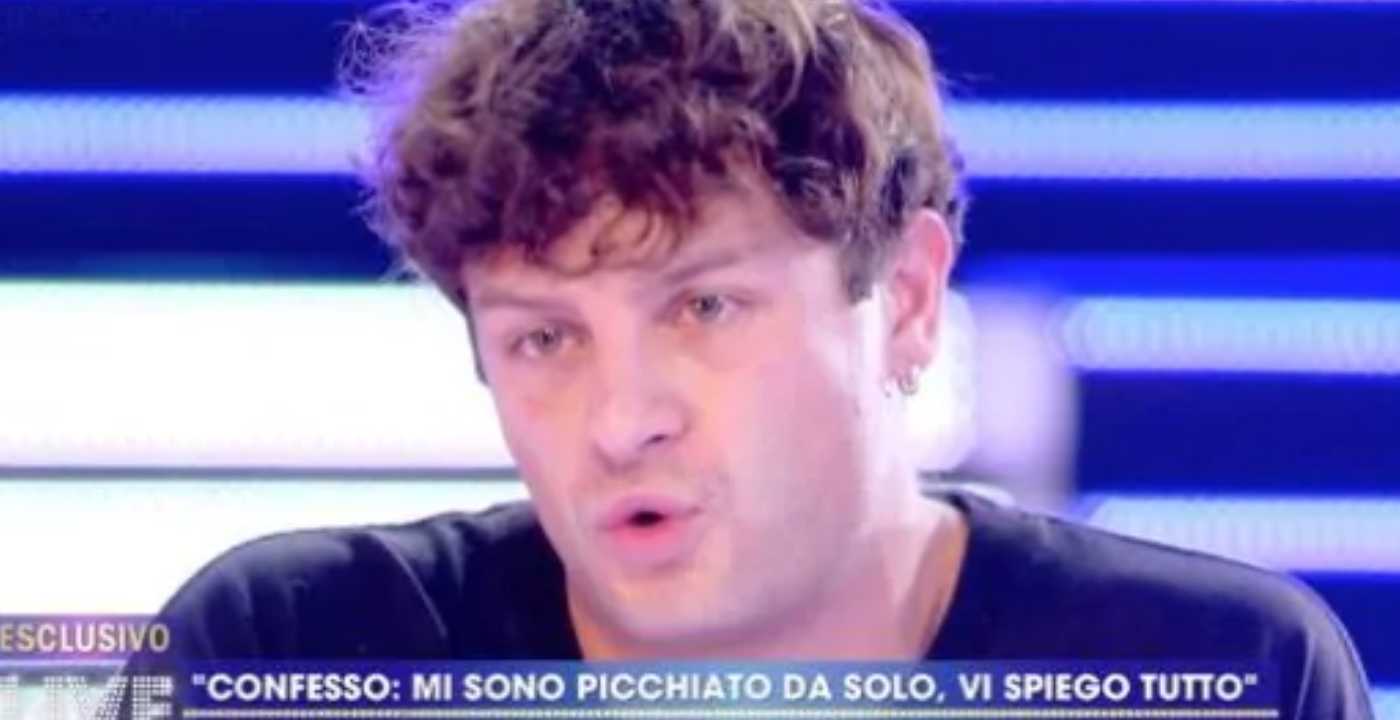 Live – Non è la d’Urso, Iconize racconta la sua verità sulla finta aggressione: “Una persona mi ha spinto a fare brutte cose”