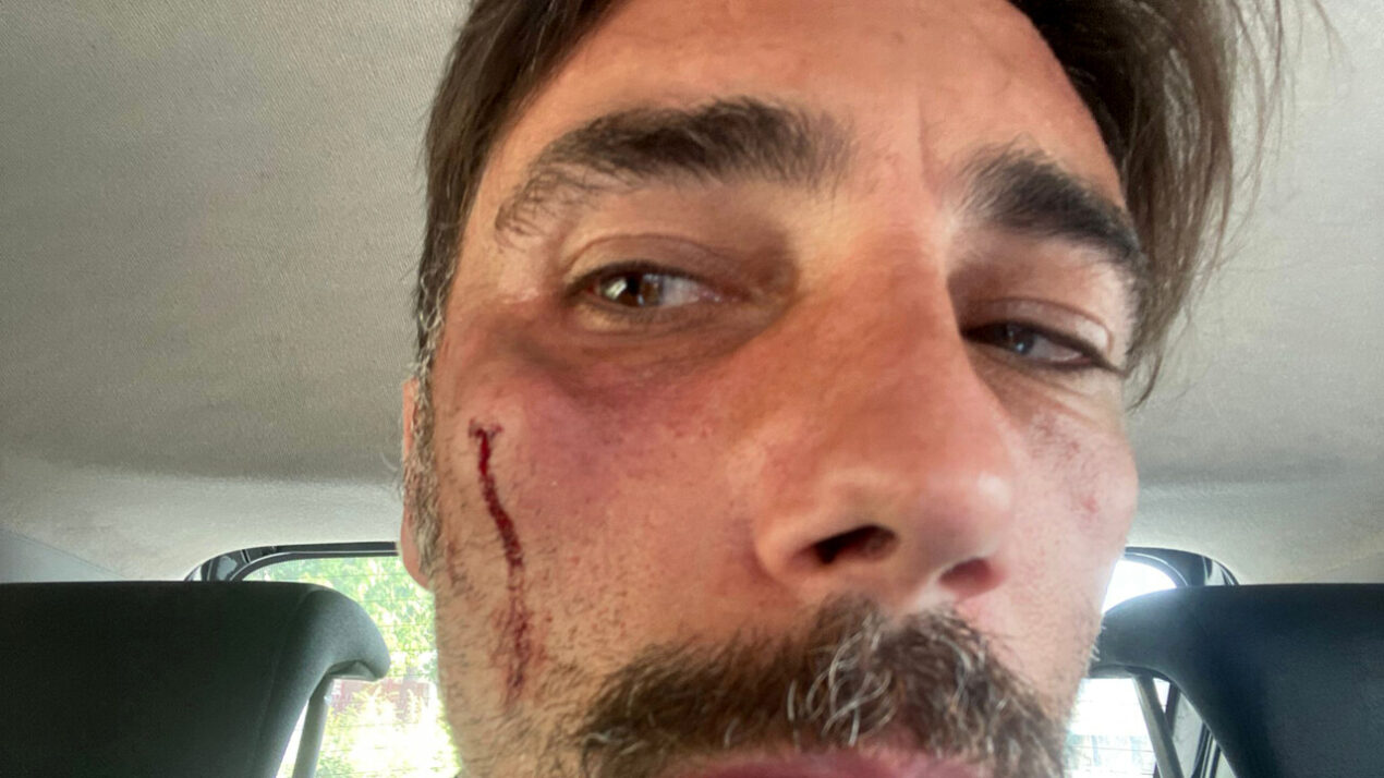 Striscia la notizia, Vittorio Brumotti ancora aggredito: "Non si può far finta di nulla"